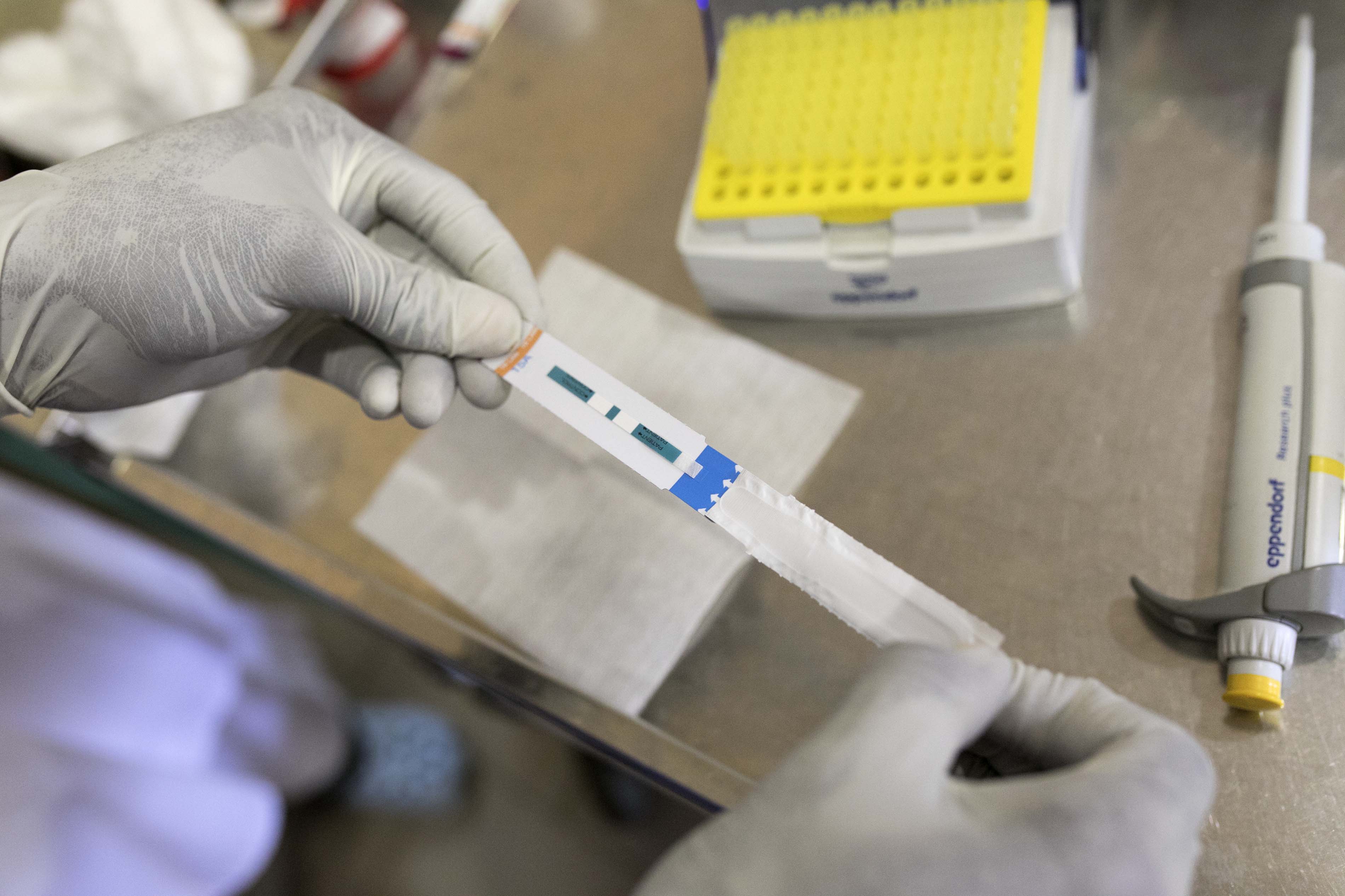 A rapid TB test for people living with HIV Médecins Sans