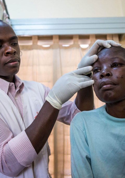 Symptoms of karposis sarcoma started showing on this patient shortly after she started taking medication. She is going to start quimiotherapy.