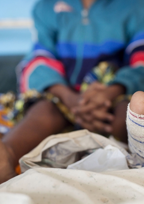 Cameroon - Buruli ulcer