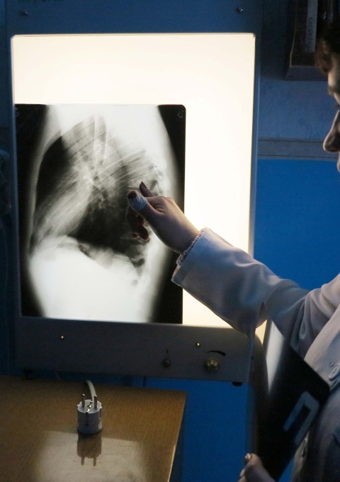A Ministry of Health nurse inspects an x-ray scan of the lungs of one patient who is supported by MSF, at the Artyomovsk TB dispensary outside Donetsk.