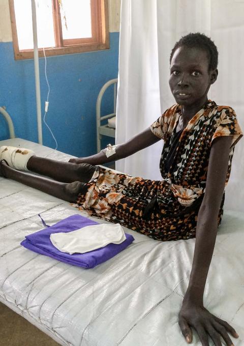 Nyekuony, 35, lost her foot and lower leg due to a snakebite that was not treated on time. She is awaiting surgery at the MSF hospital in Agok. Photograph by Alexandra Malm