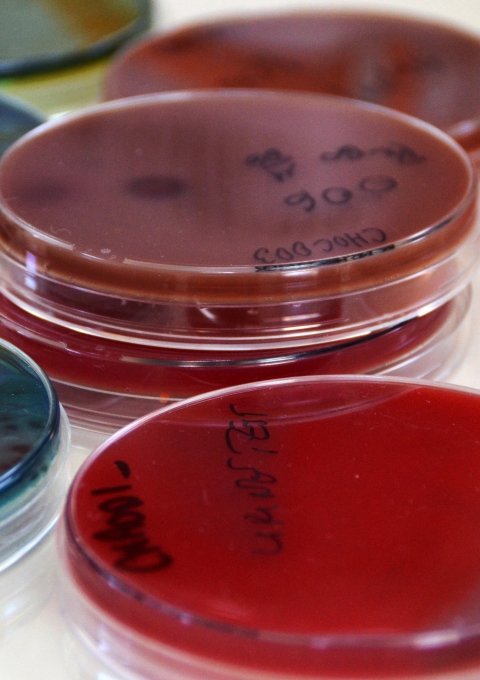 o diagnose all bacterial diseases which are affected children. The laboratory also includes a blood bank. In 2013, more than 1,600 bags had been collected of which 16% provided by volunteer donors. On 14 June 2014, MSF organized, in partnership with the Ministry of Health, various promotional activities to promote voluntary blood donation, on the occasion of the World Blood Donor Day.