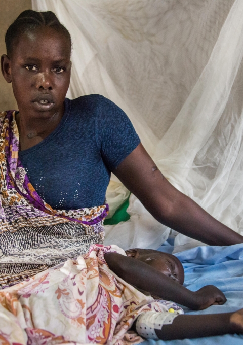 Nyamach is a 20-year-old mother of three from Ulang. Her youngest child, a five-year-old girl, was admitted to MSF’s hospital in late March with convulsions and fever and was diagnosed with cerebral malaria. The child also had a wound which had led to a tetanus infection. Vaccination coverage among the local population is low.