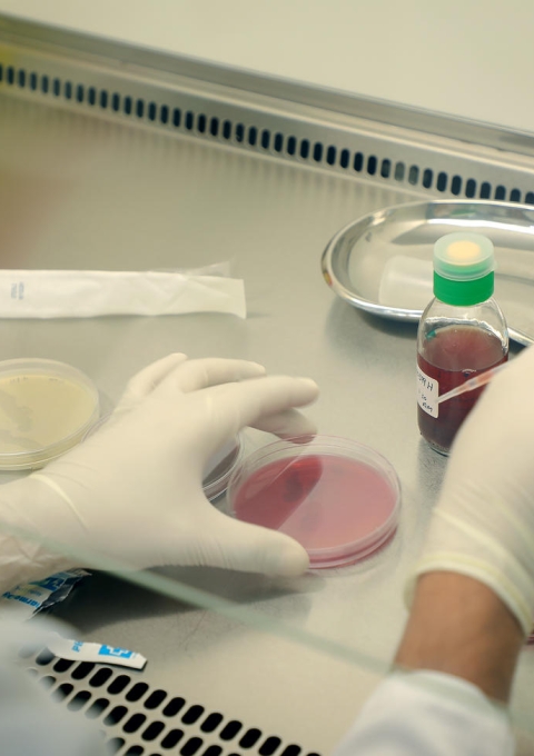 MSF bio lab at MSF’s Aden hospital controls and treats the anti-resistant infected cases.   Aden-The Bio lab project was launched as part of the medical lab at MSF Aden hospital southern Yemen, on January 2017.