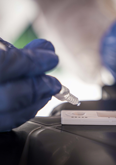 During MSF mobile clinic activities in the Grande Bom Jardim territory and the José Walter neighborhood, in Fortaleza, MSF tested symptomatic cases of COVID-19 with rapid antigen tests.