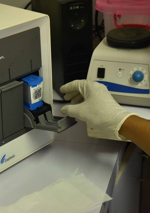A sample is inserted into the GeneXpert machine in MSF's lab in Kerema General Hospital, Kerema. The machine has revolutionised TB diagnosis, detecting the TB bacterium and any drug resistance within a matter of hours.