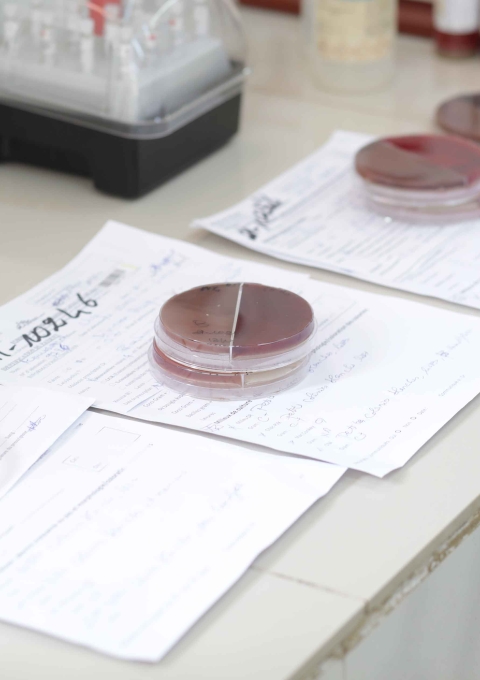 Three samples from 3 patients plated on culture media to identify bacteria in the CSREF laboratory in Koutiala, Mali.