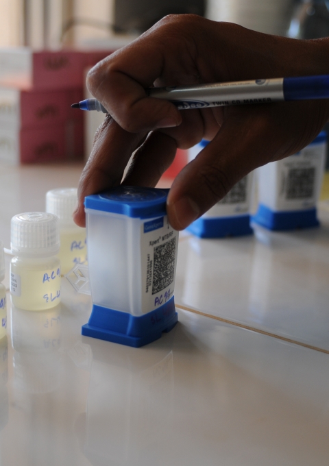 Sputum being readied for testing in the GeneXpert TB diagnostic machine