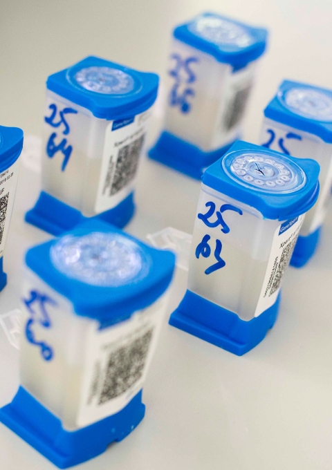 Cartridges with samples for GeneXpert test system used for rapid TB and rifampicin-resistance diagnostics.