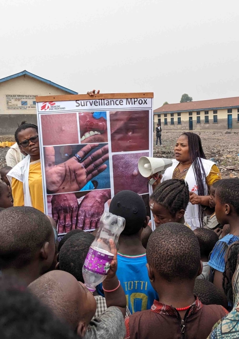The Mpox epidemic is increasingly affecting people displaced by armed conflict in Goma, North Kivu. MSF has deployed its teams of health promoters (HP) to raise awareness of the behaviour to adopt to avoid contamination. 