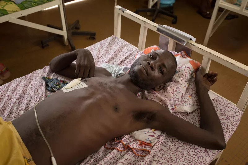 Co-infected with HIV and tuberculosis patient, treated in MSF's HIV clinic in the Hôpital Communautaire, Central African Republic 2016. 