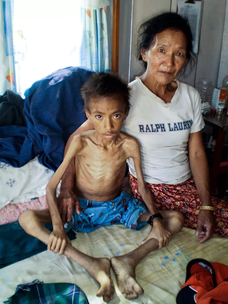 Sick child with chronic diarrhea, poor appetite and severe pulmonary tuberculosis sits on a MSF bed with her grandmother, 2009.