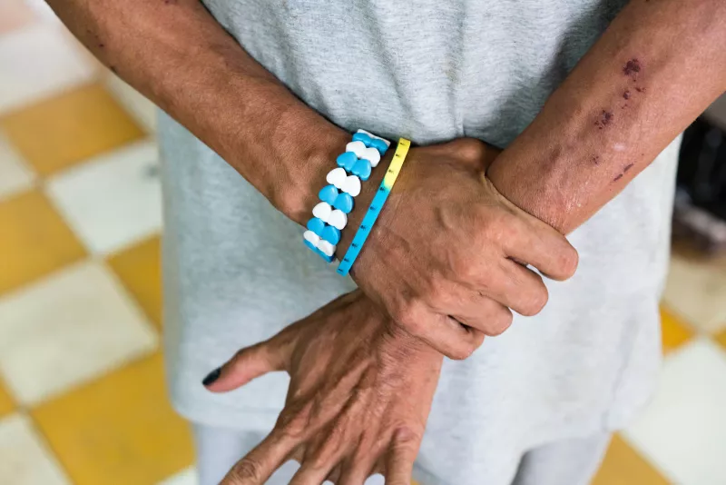 An intra-veinous drug-using client at the Mith Samlanh Drop-In Centre, which offers medical support, food and a resting area.