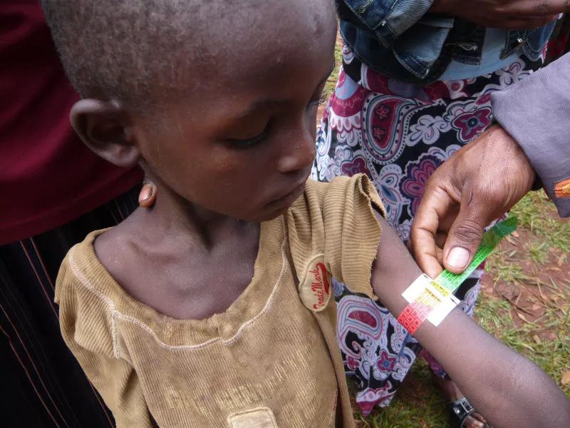 Regular screening of children for acute malnutrition, which can be done rapidly by measuring mid-upper-arm circumference (MUAC), is a critical part of diagnosing children at risk of death.