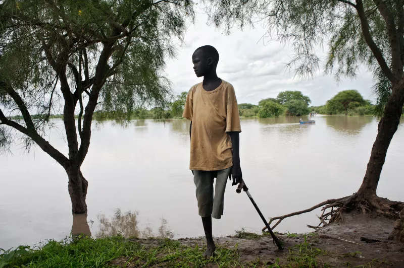 A boy, with an amputated leg due to lack of access to care after being bitten by a snake, on the banks of the Pibor River in Jonglei State