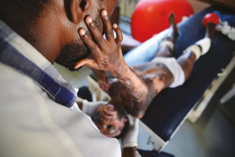 Stretching exercises, often painful for the patient, are really important to achieve and retain supple skin. Supple skin enables freedom of multi-directional movements. To be effective, the exercises must be repeated several times a day. Photograph by Aurelie Baumel