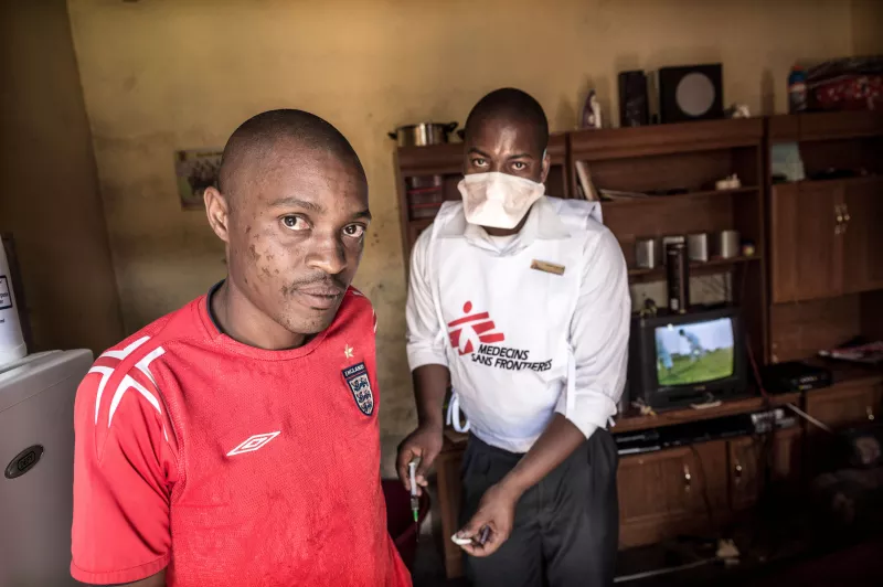 Dumsami receives daily injections in the buttocks, they are painful and part of his lengthy MDR-TB treatment, that he has been ondergoing since 3 months. He is also HIV-positive.