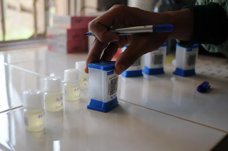 Sputum being readied for testing in the GeneXpert TB diagnostic machine, Tboung Khmum District Referral Hospital, Cambodia