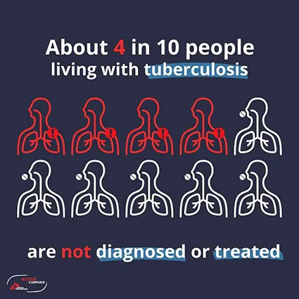 About 4 in 10 people living with tuberculosis are not diagnosed or treated