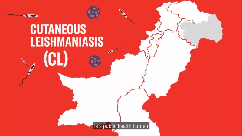Cutaneous Leishmaniasis in Pakistan
