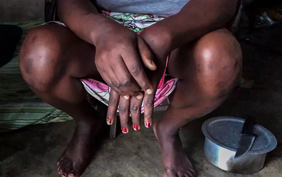 Virginia is a Malawian sex worker living in Beira, Mozambique. She works to support her nephew and nieces after their parents died from HIV. Virginia recently found out she was HIV positive but is afraid to start treatment, for a number of reasons.