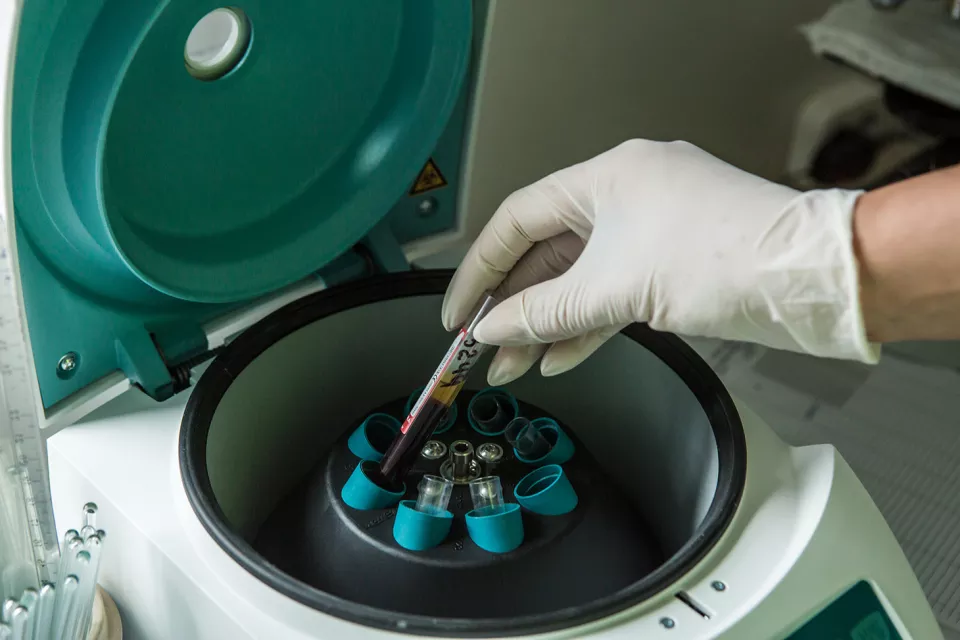 Use of a centrifuge to separate serum from other blood components in the laboratory of the Zhytomyr Regional TB Dispensary.