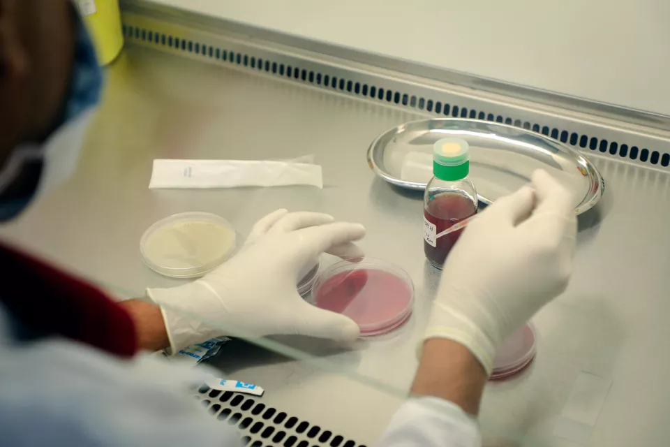 MSF bio lab at MSF’s Aden hospital controls and treats the anti-resistant infected cases.   Aden-The Bio lab project was launched as part of the medical lab at MSF Aden hospital southern Yemen, on January 2017.