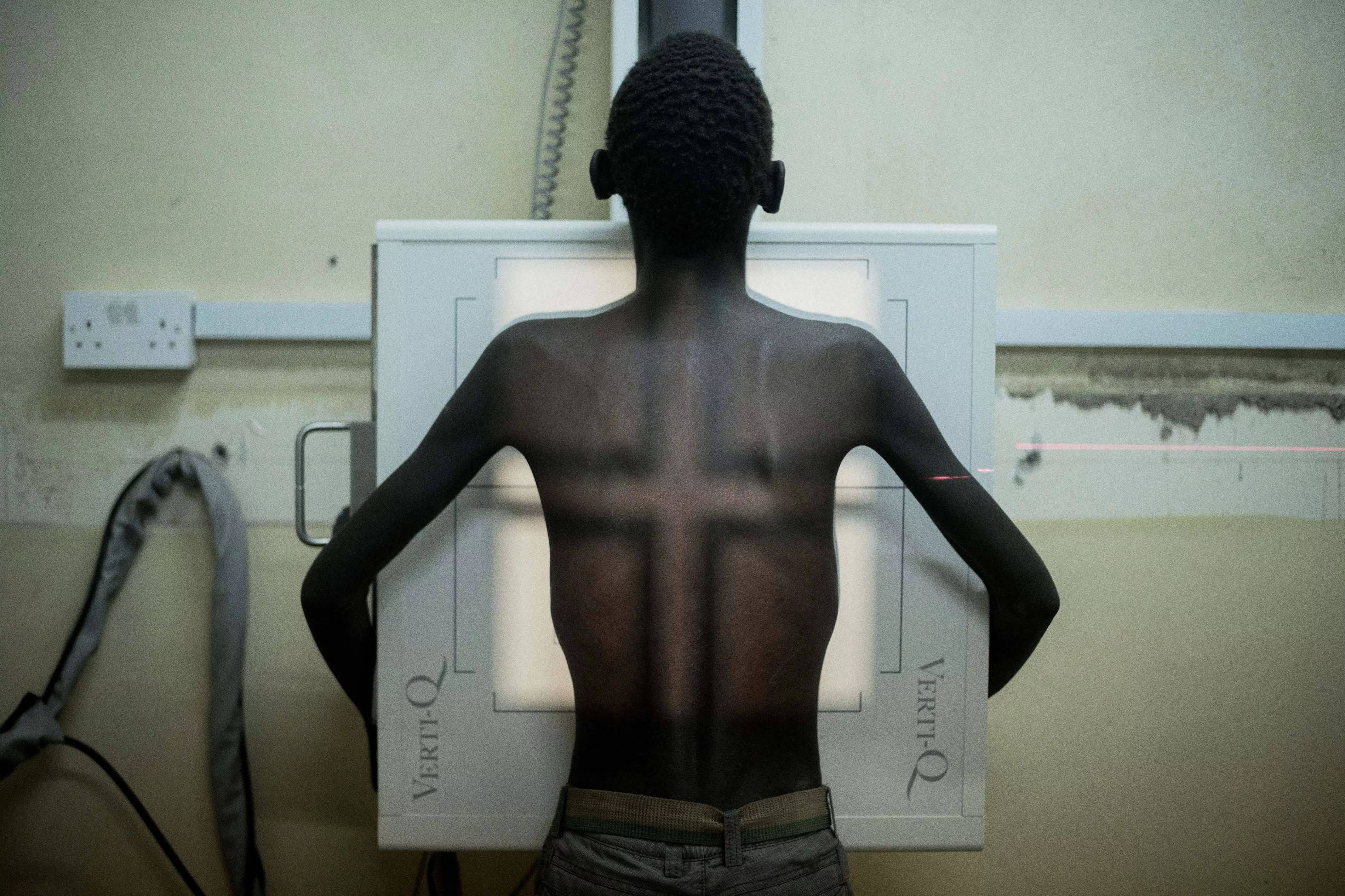 Nsanje, Malawi: Simbazako, 19 years, undergoes radiography for tuberculosis in Nsanje district hospital, Malawi. He says: “I feel too much pain in my ribs. I take my ARVs without skipping even a day but my health is not improving as I had expected.”