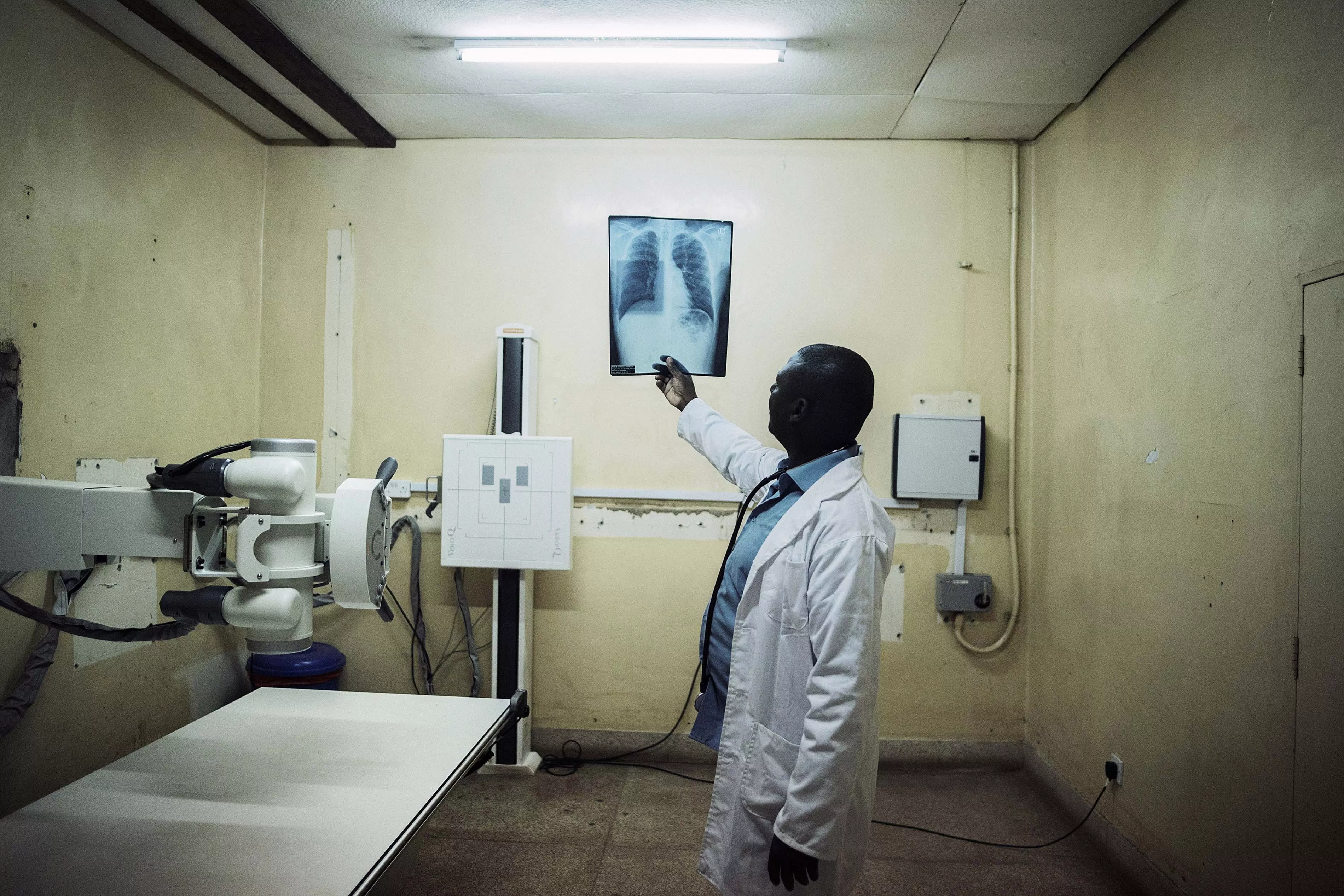 Malawi. June 30, 2017. Patrick Chipungu, 51 years, an MSF clinician looks at Simbazako Thove's X-Ray. Simbazako is 19 years and HIV and TB positive.