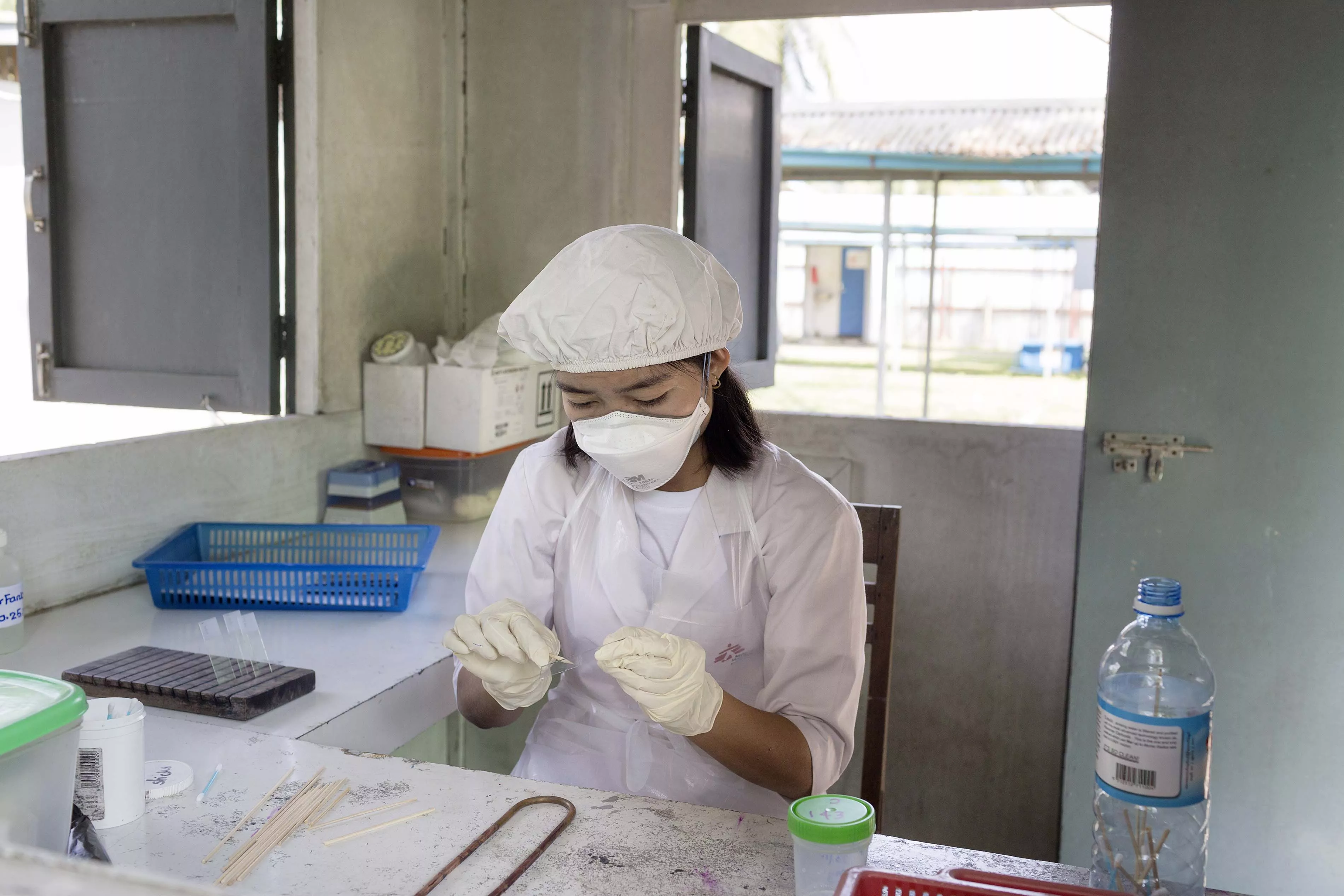MSF staff member Nant Poe Ou performs an initial screening of a sputum sample for the presence of mycobacterium tuberculosis at MSF's Insein clinic in Yangon, Myanmar, Feb. 22, 2018.