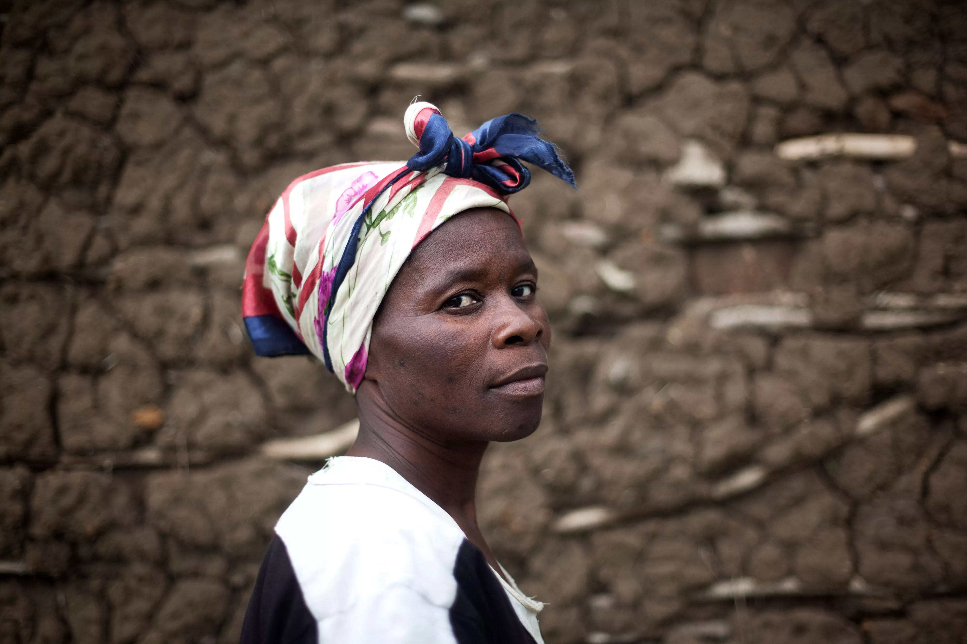 A person living with HIV on ART from Mnyatsini village in the Shiselweni region, south of Swaziland.