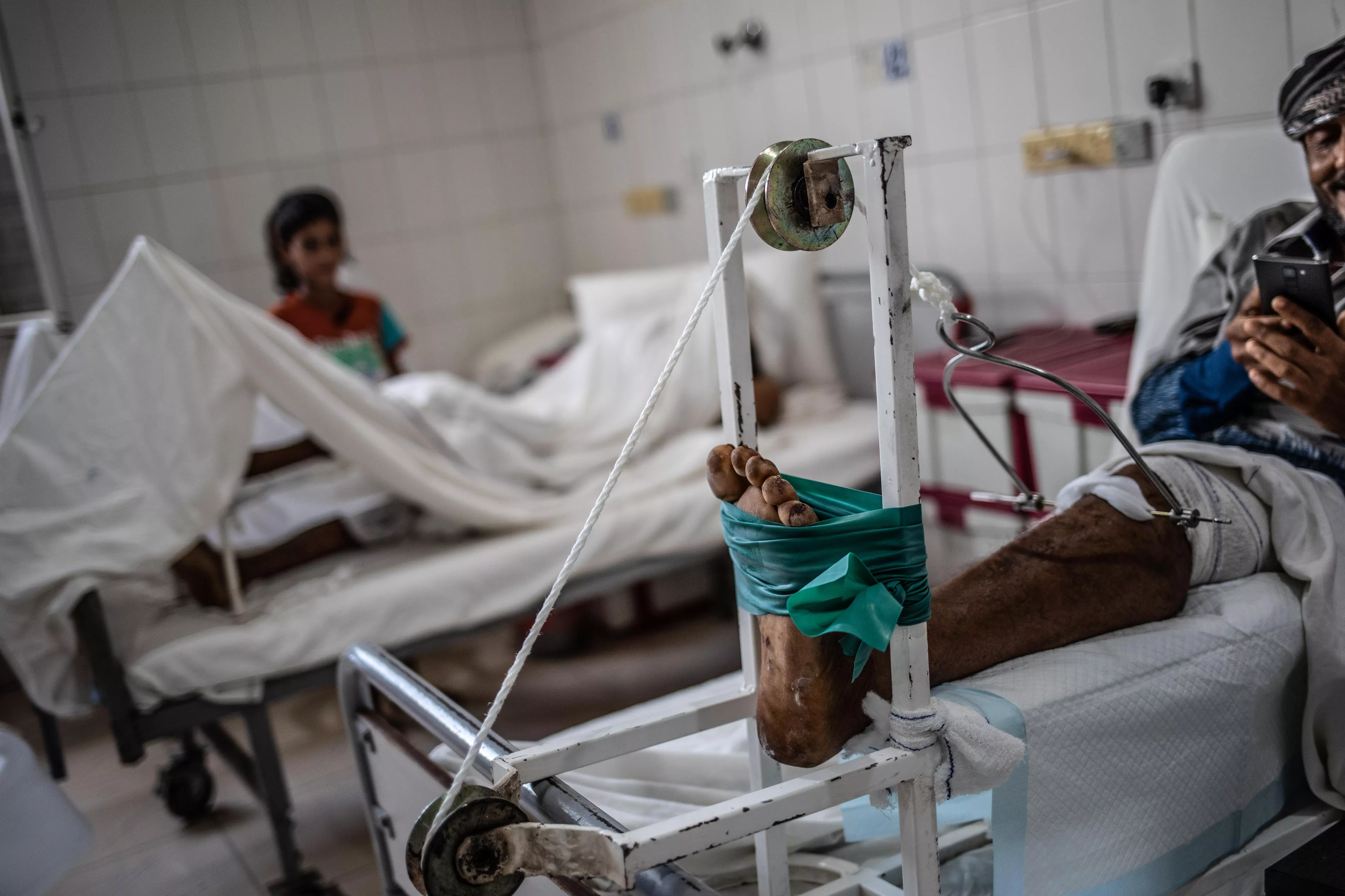 Abdallah is a patient at MSF’s trauma hospital in Aden (Yemen). MSF’s hospital mostly treats war-wounded patients. Abdallah was shot in the leg by a sniper. He eventually arrived at MSF surgical hospital in Mocha 12 hours after being injured.