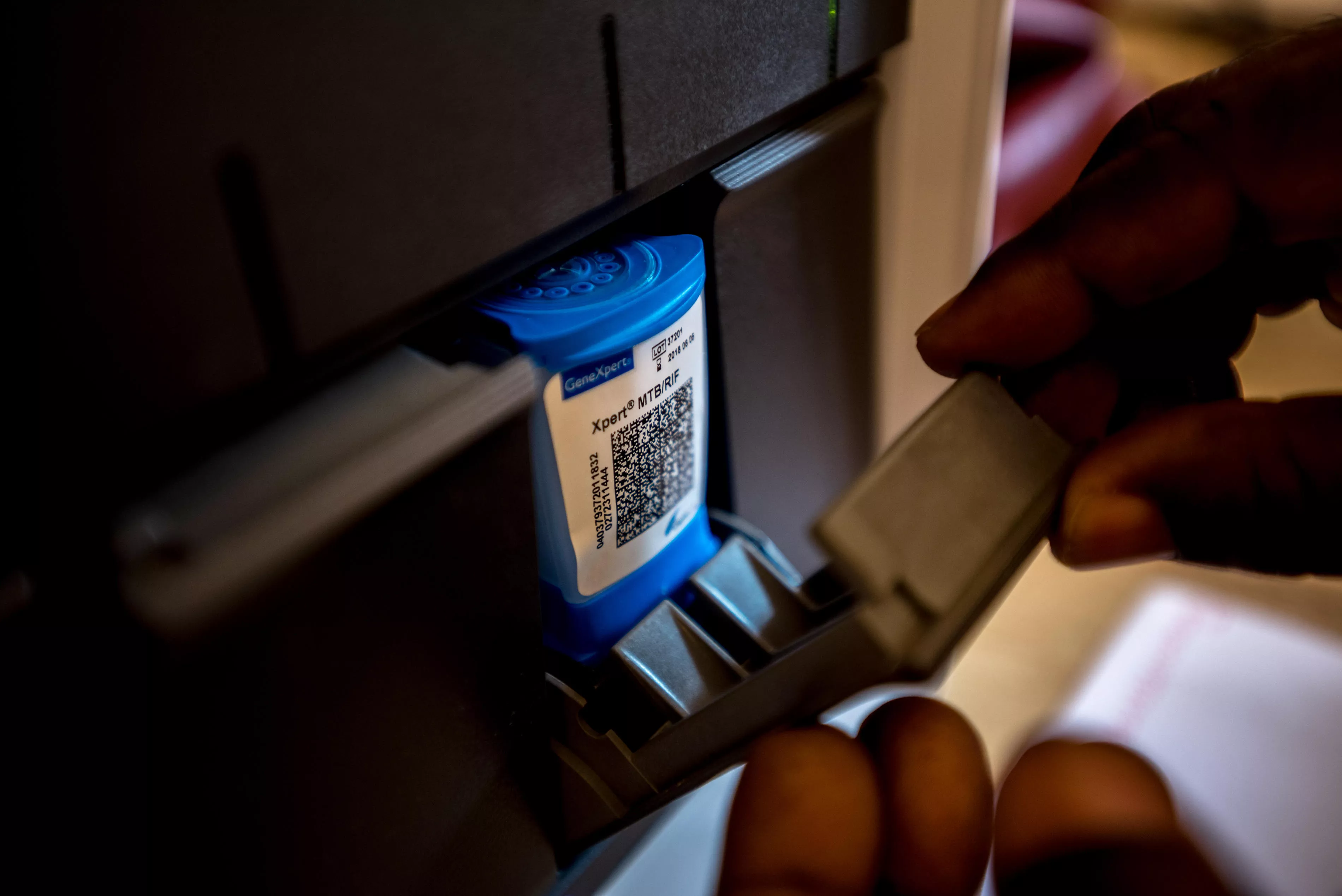 GeneXpert test cartridge being used to test a sample of suspected TB in MSF’s lab at Bangassou Hospital, Central African Republic, 2017.