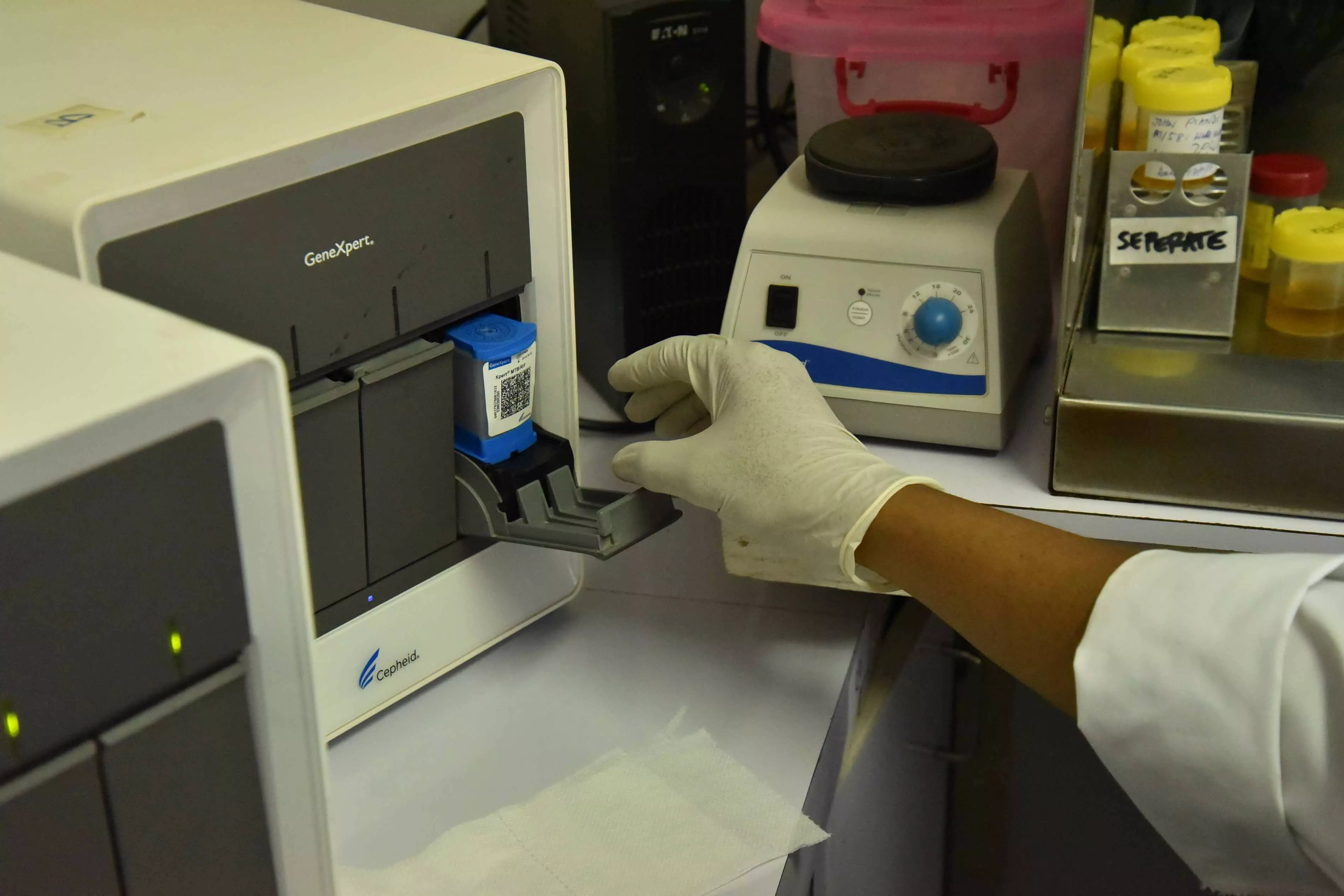 A sample is inserted into the GeneXpert machine in MSF's lab in Kerema General Hospital, Kerema. The machine has revolutionised TB diagnosis, detecting the TB bacterium and any drug resistance within a matter of hours.