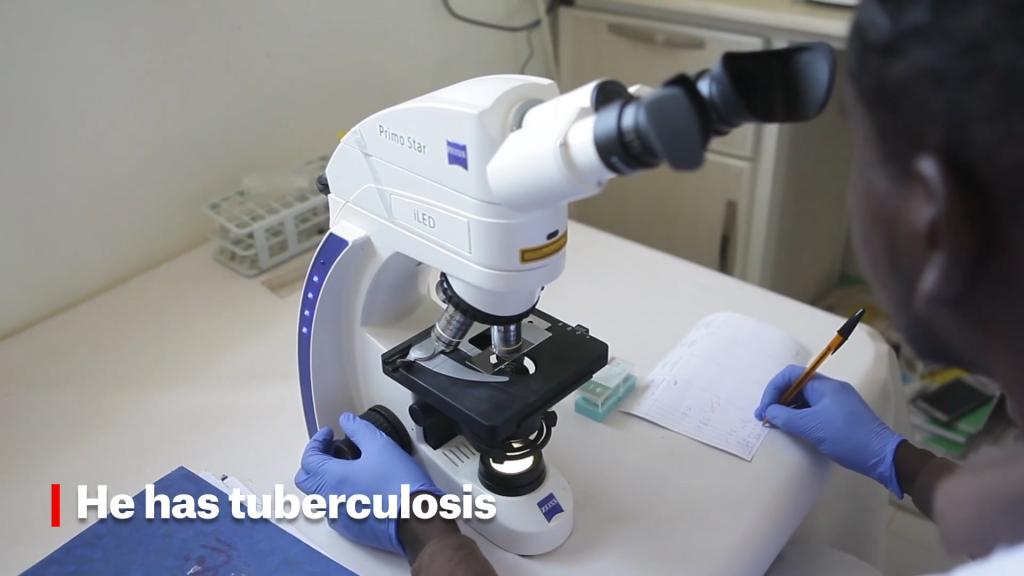 Tackling TB in Sudan