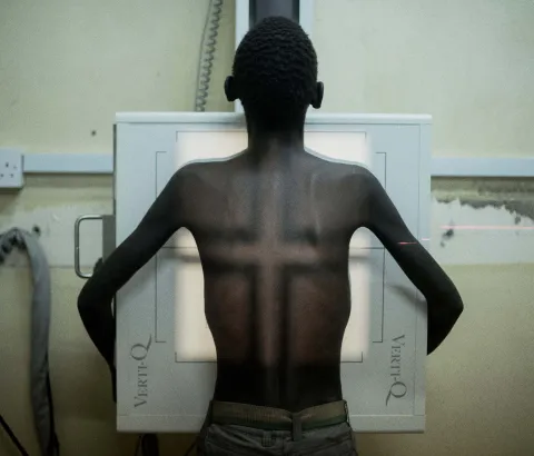 Nsanje, Malawi: Simbazako, 19 years, undergoes radiography for tuberculosis in Nsanje district hospital, Malawi. He says: “I feel too much pain in my ribs. I take my ARVs without skipping even a day but my health is not improving as I had expected.”