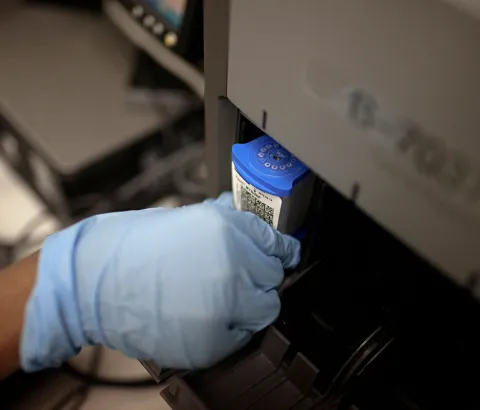 Medical officer Neisha Mohess, scans a sample of sputum for loading into an automated molecular TB diagnostic machine called GeneXpert.