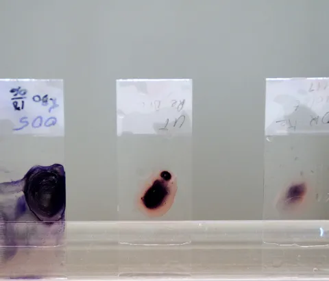 End of 2013, MSF initiated the restructuring and renovation of the central laboratory of Koutiala hospital, where MSF manages the pediatric unit. Photograph by Aurelie Baumel