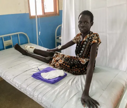 Nyekuony, 35, lost her foot and lower leg due to a snakebite that was not treated on time. She is awaiting surgery at the MSF hospital in Agok. Photograph by Alexandra Malm