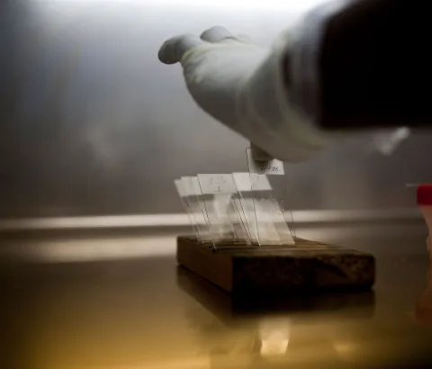 A sputum sample analysis at the Blue House Clinic in Kenya, 2011.