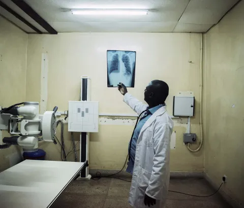 Malawi. June 30, 2017. Patrick Chipungu, 51 years, an MSF clinician looks at Simbazako Thove's X-Ray. Simbazako is 19 years and HIV and TB positive.