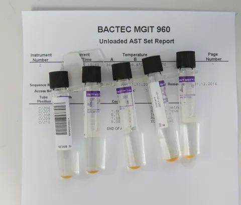Bacteria culture tubes for BACTEC™ MGIT™ 960 Mycobacterial detection system in the National TB Reference Laboratory. This device helps growing and detecting TB bacteria and determining drug resistances. Government Hospital, Mbabane, Swaziland. Photograph by Alexis Huguet
