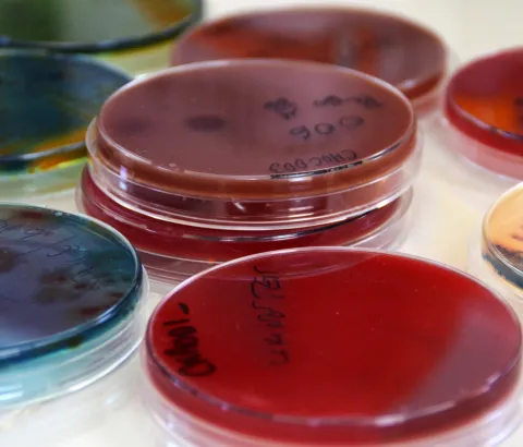 o diagnose all bacterial diseases which are affected children. The laboratory also includes a blood bank. In 2013, more than 1,600 bags had been collected of which 16% provided by volunteer donors. On 14 June 2014, MSF organized, in partnership with the Ministry of Health, various promotional activities to promote voluntary blood donation, on the occasion of the World Blood Donor Day.