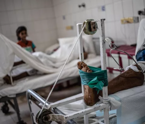 Abdallah is a patient at MSF’s trauma hospital in Aden (Yemen). MSF’s hospital mostly treats war-wounded patients. Abdallah was shot in the leg by a sniper. He eventually arrived at MSF surgical hospital in Mocha 12 hours after being injured.