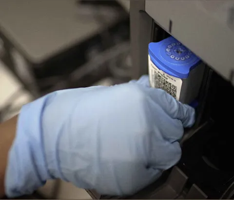 The GeneXpert machine can identify the bacteria responsabile for tuberculosis (Mycobacterium tuberculosis) and also drug resistant TB